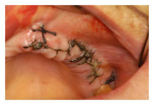 Details are in the caption following the image Details are in the caption following the image