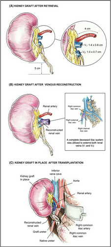 Details are in the caption following the image