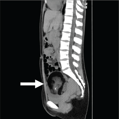 Details are in the caption following the image