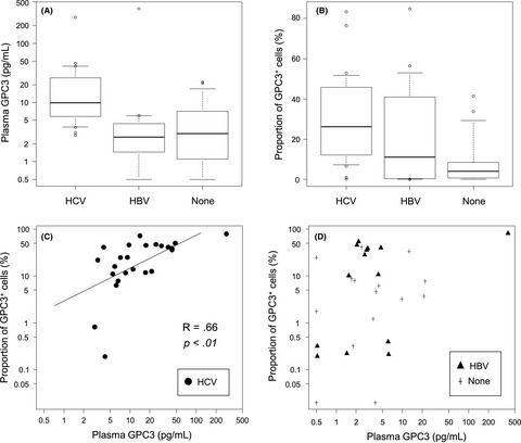 Plasma and tumoral glypican-3 levels are correlated in patients with hepatitis C virus-related hepatocellular carcinoma