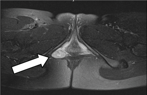Details are in the caption following the image