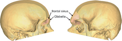 Frontal sinus ontogeny and covariation with bone structures in a modern human population