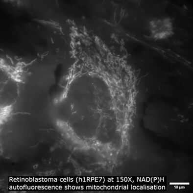 Emerging clinical applications in oncology for non-invasive multi- and hyperspectral imaging of cell and tissue autofluorescence
