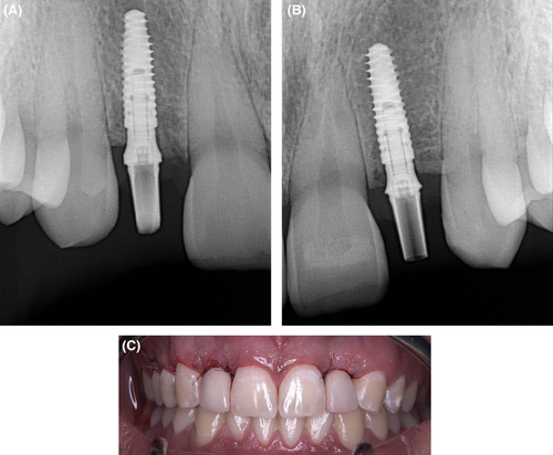 Details are in the caption following the image Details are in the caption following the image