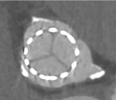 Details are in the caption following the image