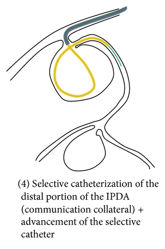 Details are in the caption following the image