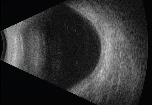 Details are in the caption following the image