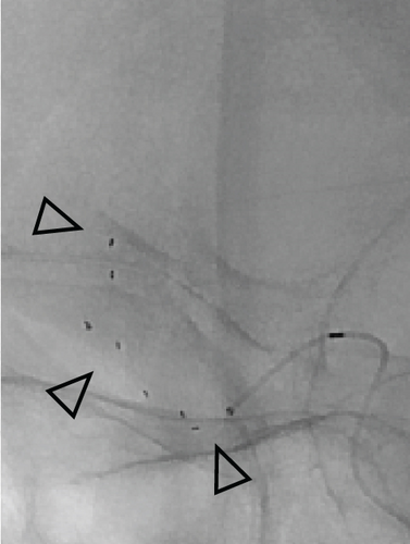 Details are in the caption following the image