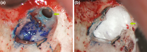 Details are in the caption following the image Details are in the caption following the image