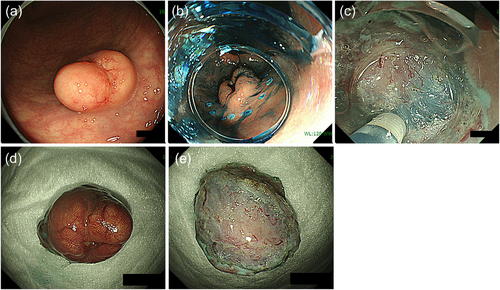 Details are in the caption following the image Details are in the caption following the image