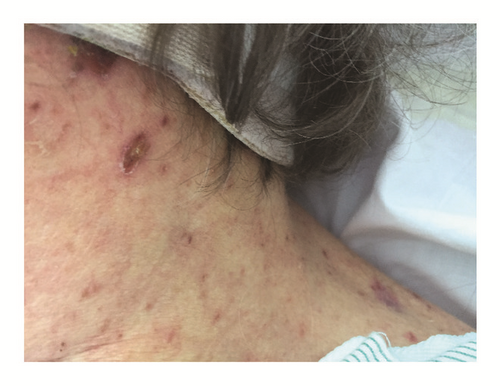 Details are in the caption following the image Details are in the caption following the image