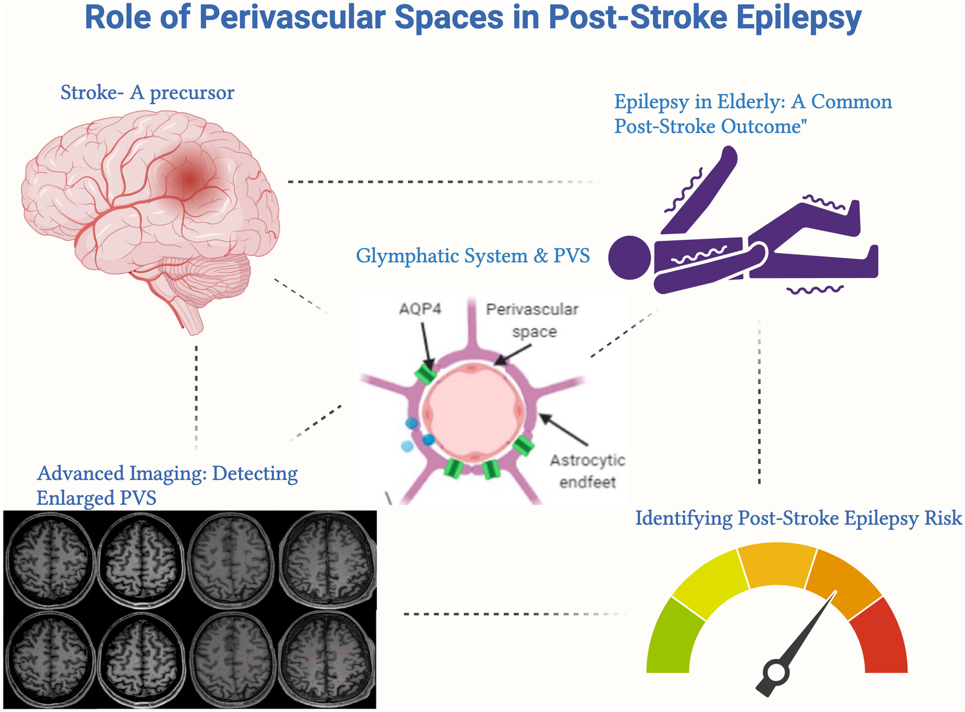 Role of the glymphatic system and perivascular spaces as a potential biomarker for post-stroke epilepsy