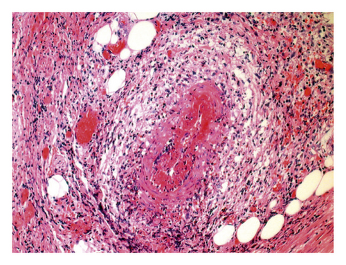 Details are in the caption following the image
