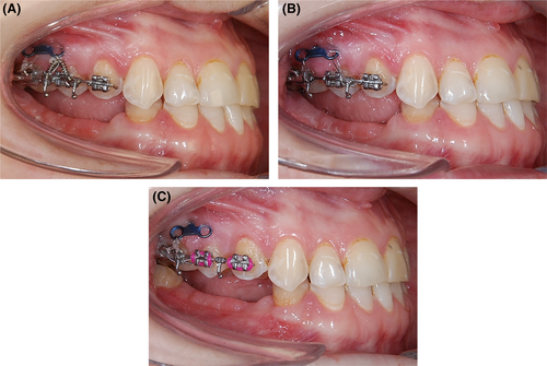 Details are in the caption following the image Details are in the caption following the image