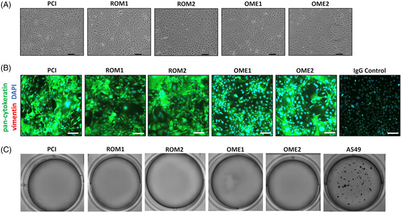 Establishment of novel immortalized middle ear cell lines as models for otitis media