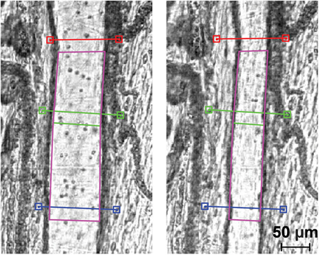 High-speed microscopy for in vivo monitoring of lymph dynamics