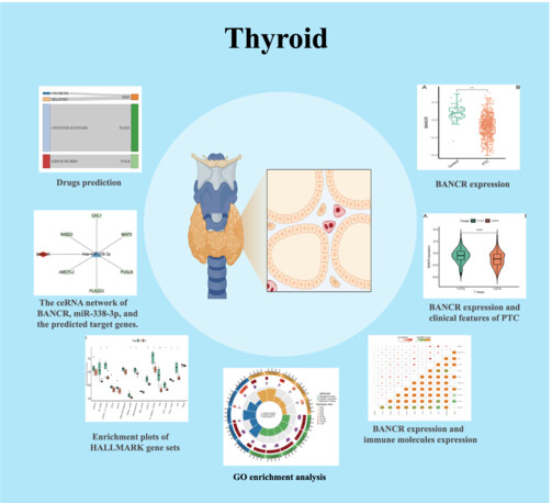 Interaction of BANCR in the relationship between Hashimoto’s thyroiditis and papillary thyroid carcinoma expression patterns and possible molecular mechanisms