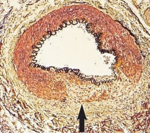 Details are in the caption following the image