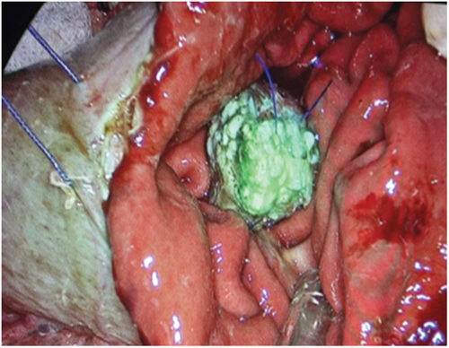 Details are in the caption following the image Details are in the caption following the image