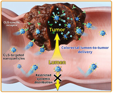 Elucidating a Tumor-Selective Nanoparticle Delivery Mechanism at the Colorectal Lumen–Tumor Interface for Precise Local Cancer Therapy