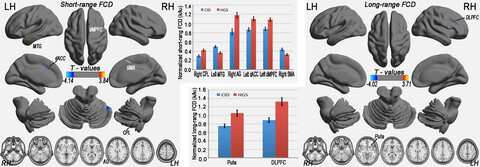 Altered long- and short-range functional connectivity density associated with poor sleep quality in patients with chronic insomnia disorder: A resting-state fMRI study