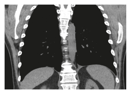 Details are in the caption following the image