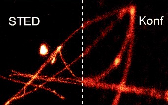 Fluoreszenznanoskopie einzelner DNA-Moleküle mit Fluoreszenzverhinderung durch stimulierte Emission (STED)