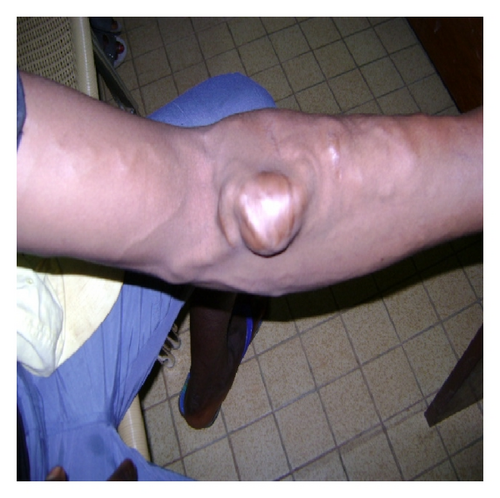 Details are in the caption following the image