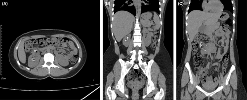 Details are in the caption following the image Details are in the caption following the image