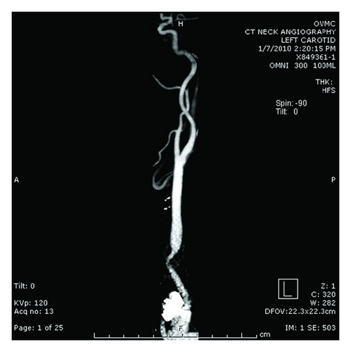 Details are in the caption following the image