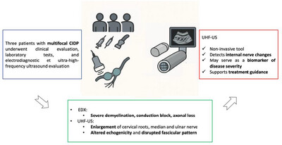 Exploring Ultrasonographic Atypical Aspects in Drug-Resistant Multifocal Chronic Inflammatory Demyelinating Polyneuropathy