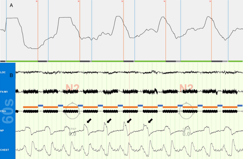 Details are in the caption following the image Details are in the caption following the image