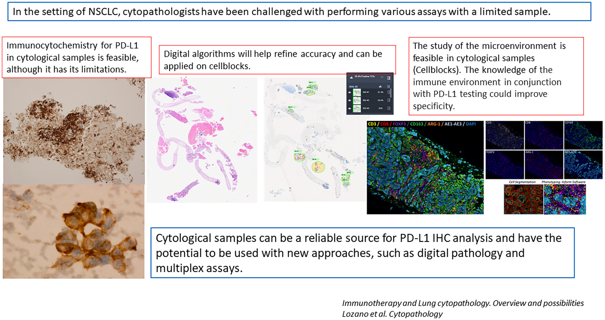 Immunotherapy and lung cytopathology: Overview and possibilities