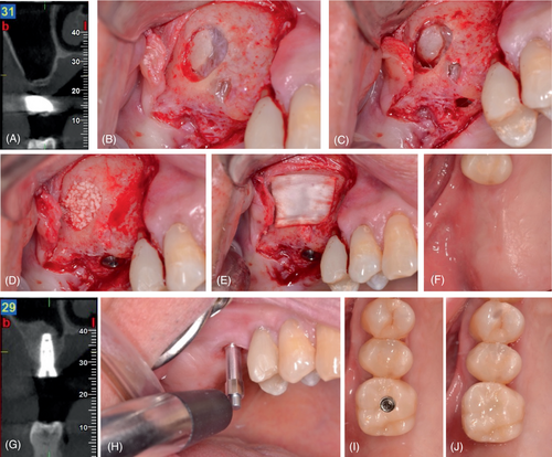 Details are in the caption following the image Details are in the caption following the image