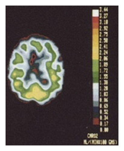 Details are in the caption following the image