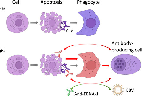 Autoantibodies against complement component C1q in systemic lupus erythematosus