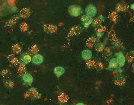 Gold Nanoparticles of Diameter 1.4 nm Trigger Necrosis by Oxidative Stress and Mitochondrial Damage