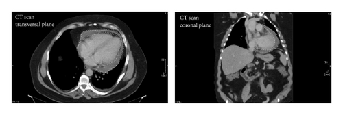 Details are in the caption following the image Details are in the caption following the image