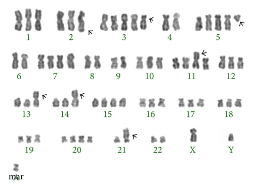 Details are in the caption following the image