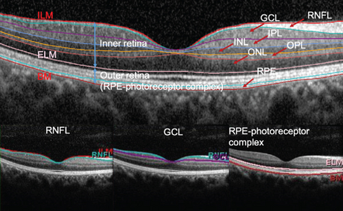 Details are in the caption following the image