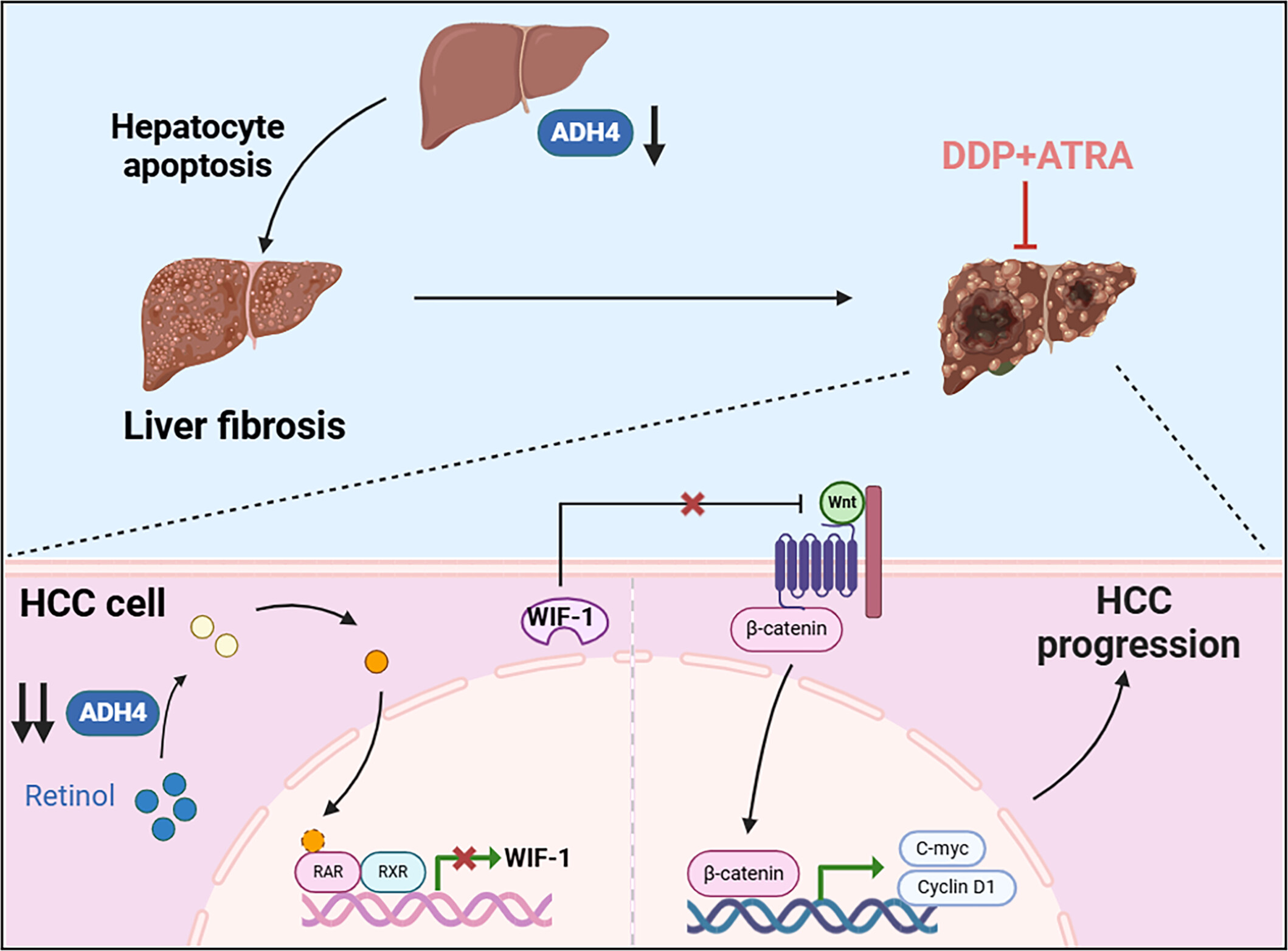 Alcohol Dehydrogenase 4-Mediated Retinol Metabolism Inhibits Hepatocellular Carcinoma Progression Through Inhibiting the Wnt/β-Catenin Pathway