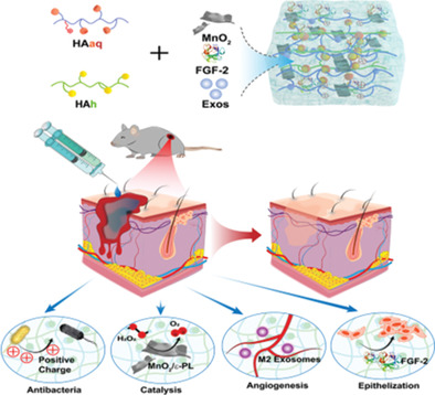 All-in-One: Multifunctional Hydrogel Accelerates Oxidative Diabetic Wound Healing through Timed-Release of Exosome and Fibroblast Growth Factor