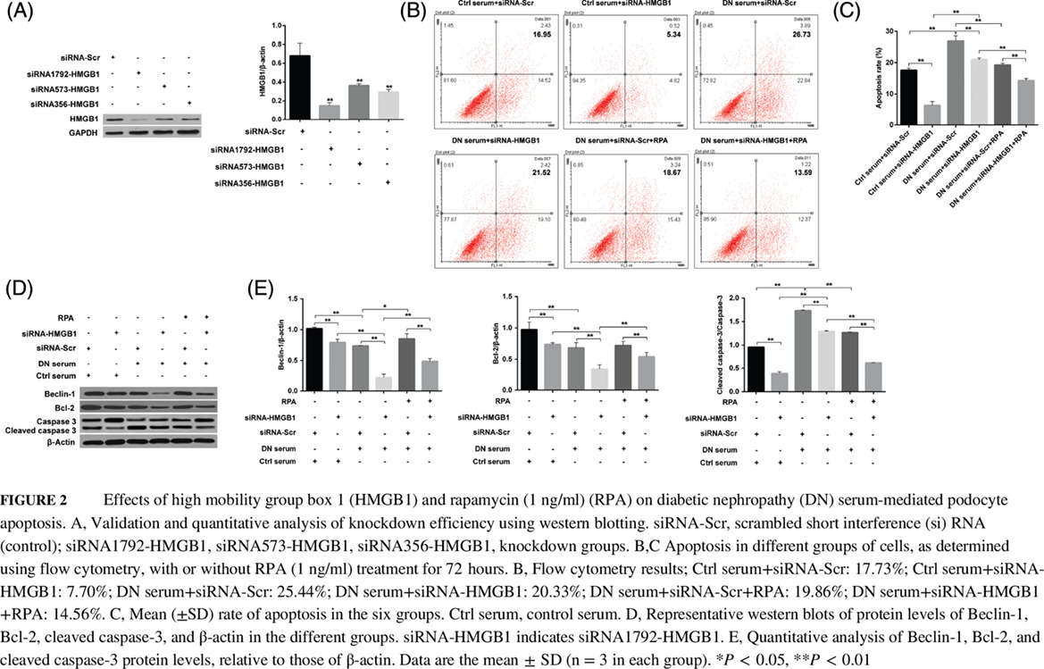 Inhibition of high mobility group box 1 (HMGB1) attenuates podocyte apoptosis and epithelial-mesenchymal transition by regulating autophagy flux 抑制HMGB1可以通过调节自噬流来减轻足细胞凋亡与上皮间充质转化