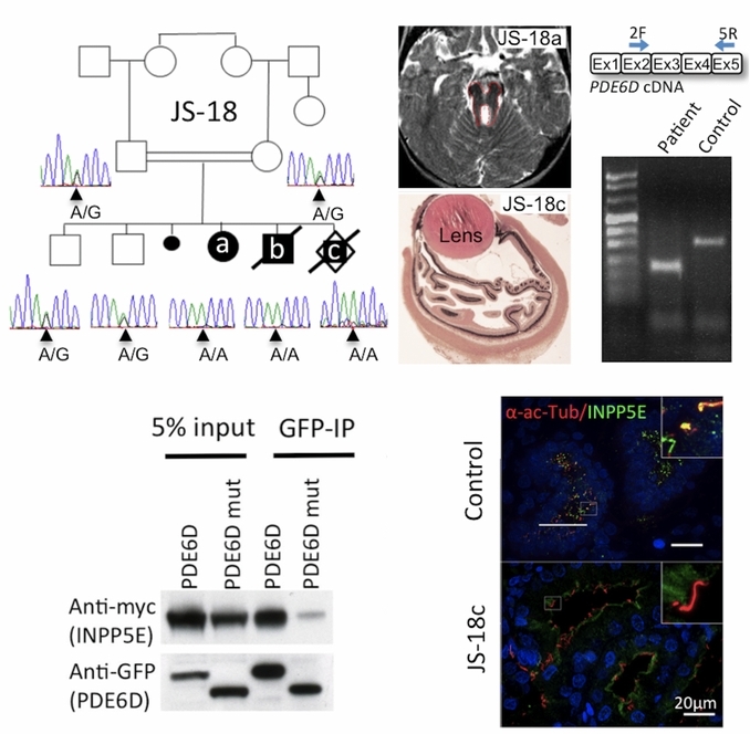 A Homozygous PDE6D Mutation in Joubert Syndrome Impairs Targeting of Farnesylated INPP5E Protein to the Primary Cilium
