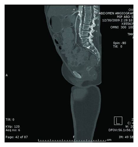 Details are in the caption following the image