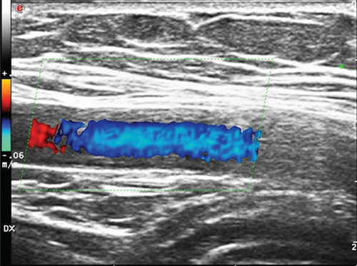 Details are in the caption following the image