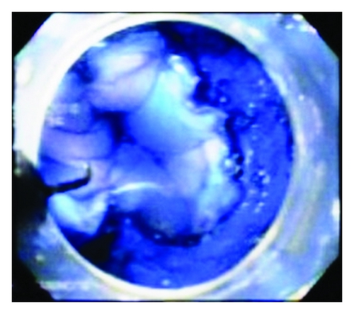 Details are in the caption following the image