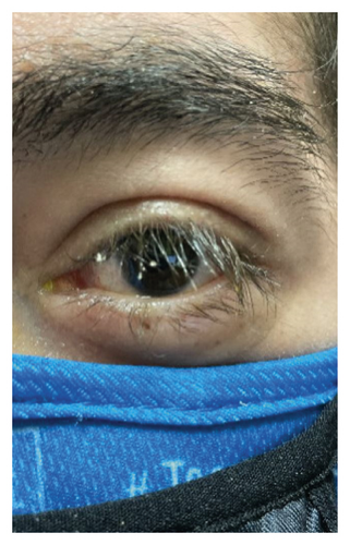 Details are in the caption following the image Details are in the caption following the image