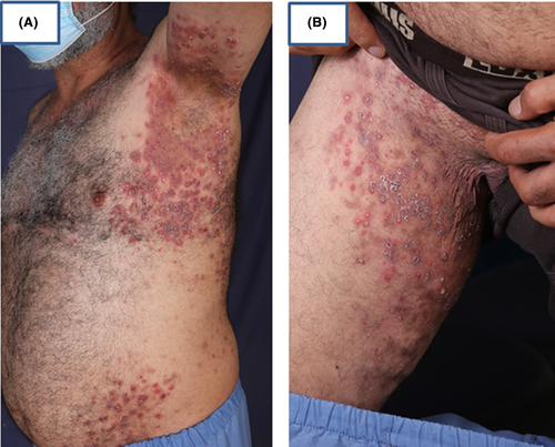 Details are in the caption following the image Details are in the caption following the image