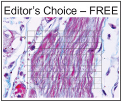 Inflammation-dependent and independent airway remodelling in asthma